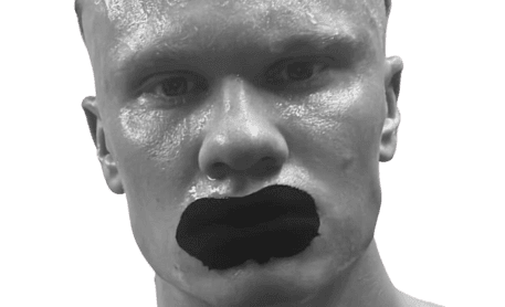 Erling Braut Haaland munnteip for nesepust
